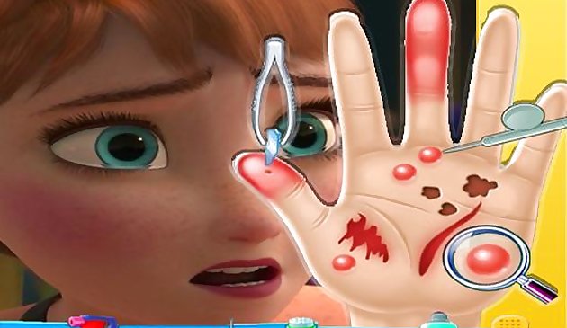 Anna frozen Hand Doctor: Giochi divertenti per ragazze Onlin