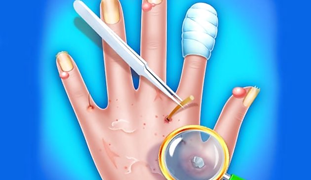طبيب جلد اليد - لعبة المستشفى